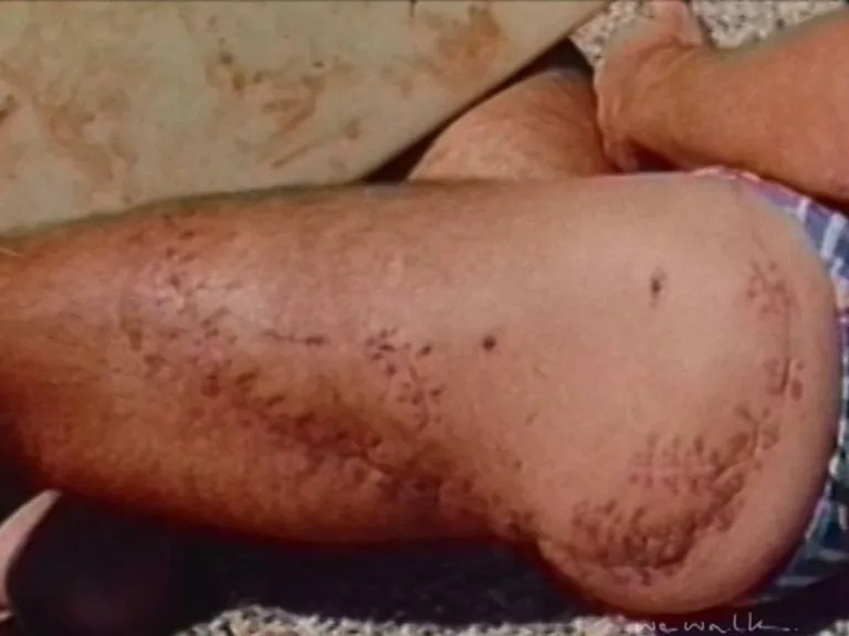 Andrew Carter's Shark Attack